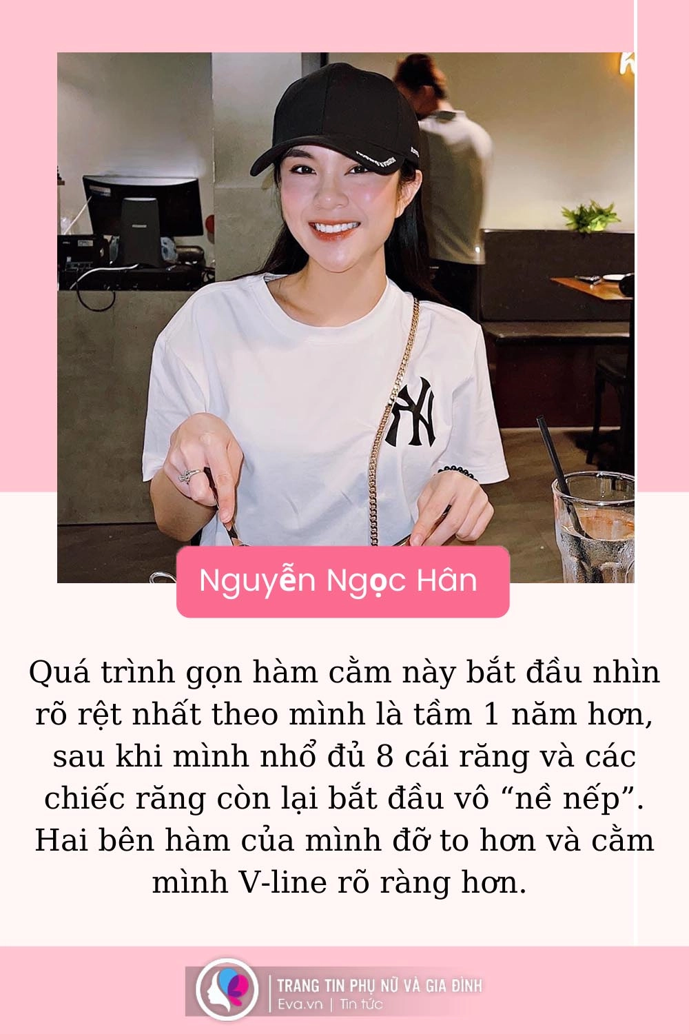 Cô gái dằn mặt người yêu cũ khi gỡ bỏ 8 chiếc răng từ vịt hoá thiên nga - 7