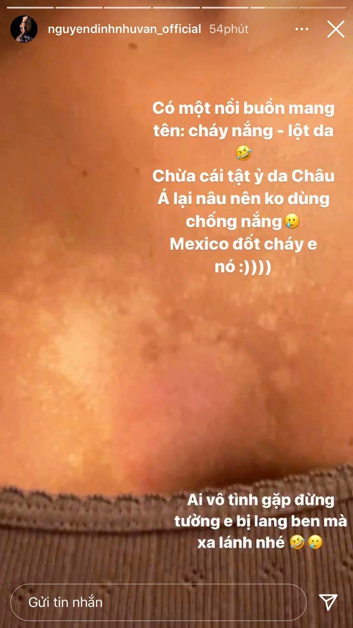 Cô giáo dạy catwalk cho đỗ thị hà gặp nạn làn da mong mọi người đừng xa lánh - 7