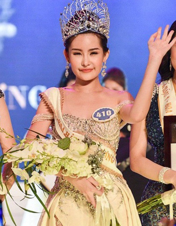 Cơ hội nào cho các cô gái lỡ dao kéo trên đấu trường sắc đẹp - 2