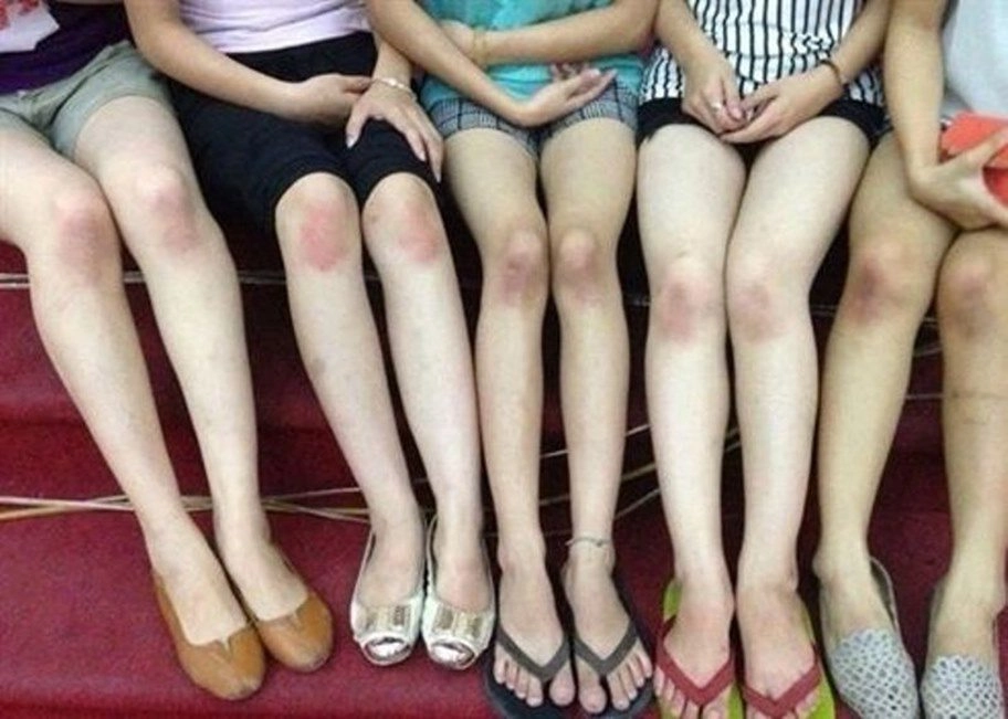 Có những vùng da không làm gì vẫn thâm đen kể ra loạt nguyên nhân ai cũng mắc phải - 1