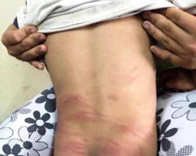 Con gái 5 tuổi khóc giữa đêm mẹ vạch áo kiểm tra phát hiện sự thật đau đớn - 2