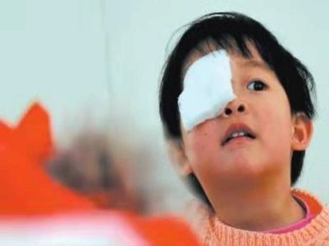 Con nhỏ keo 502 vào mắt mẹ đắp thêm khăn tẩm nước được bác sĩ khen quá thông minh - 2