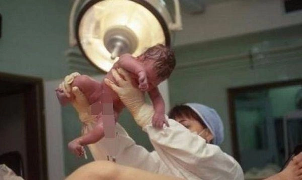 Con sơ sinh vừa chào đời bị y tá tát mạnh đến bật khóc mẹ vội vàng cảm ơn - 1