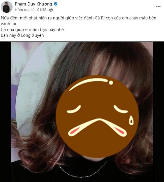 Con trai học trò trấn thành bị bảo mẫu đánh chảy máu khủng hoảng tinh thần - 3