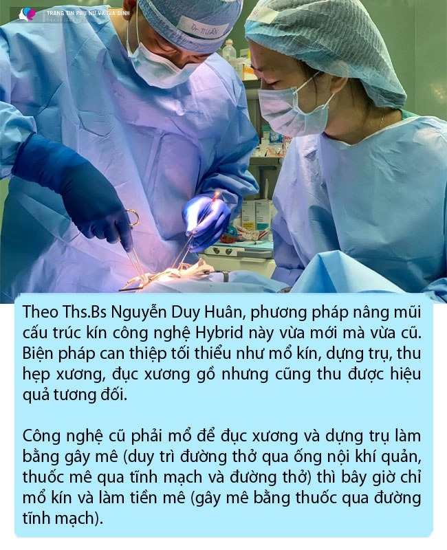 Công nghệ nâng mũi giờ đã khác ai đang có ý định thẩm mỹ đọc ngay bài viết này - 5