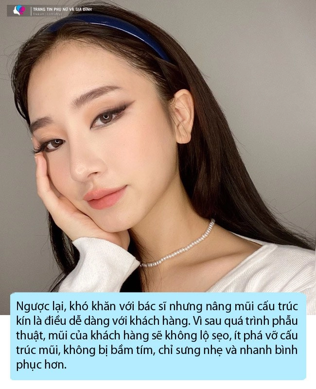 Công nghệ nâng mũi giờ đã khác ai đang có ý định thẩm mỹ đọc ngay bài viết này - 7
