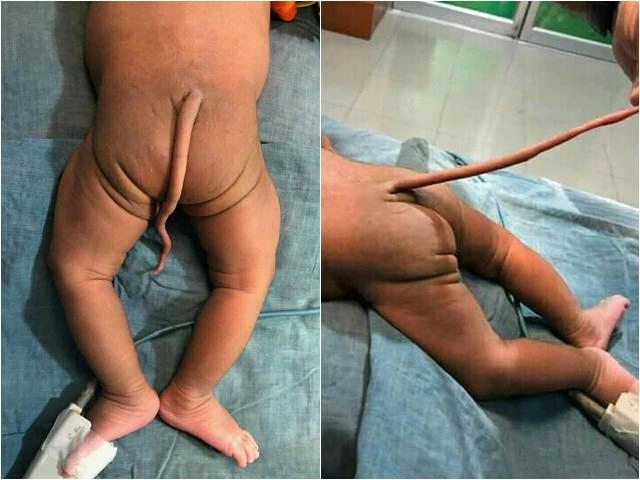 Cuộc sống kỳ lạ của bé gái sinh ra là thánh nữ đồng trinh và bi kịch khi dậy thì - 13