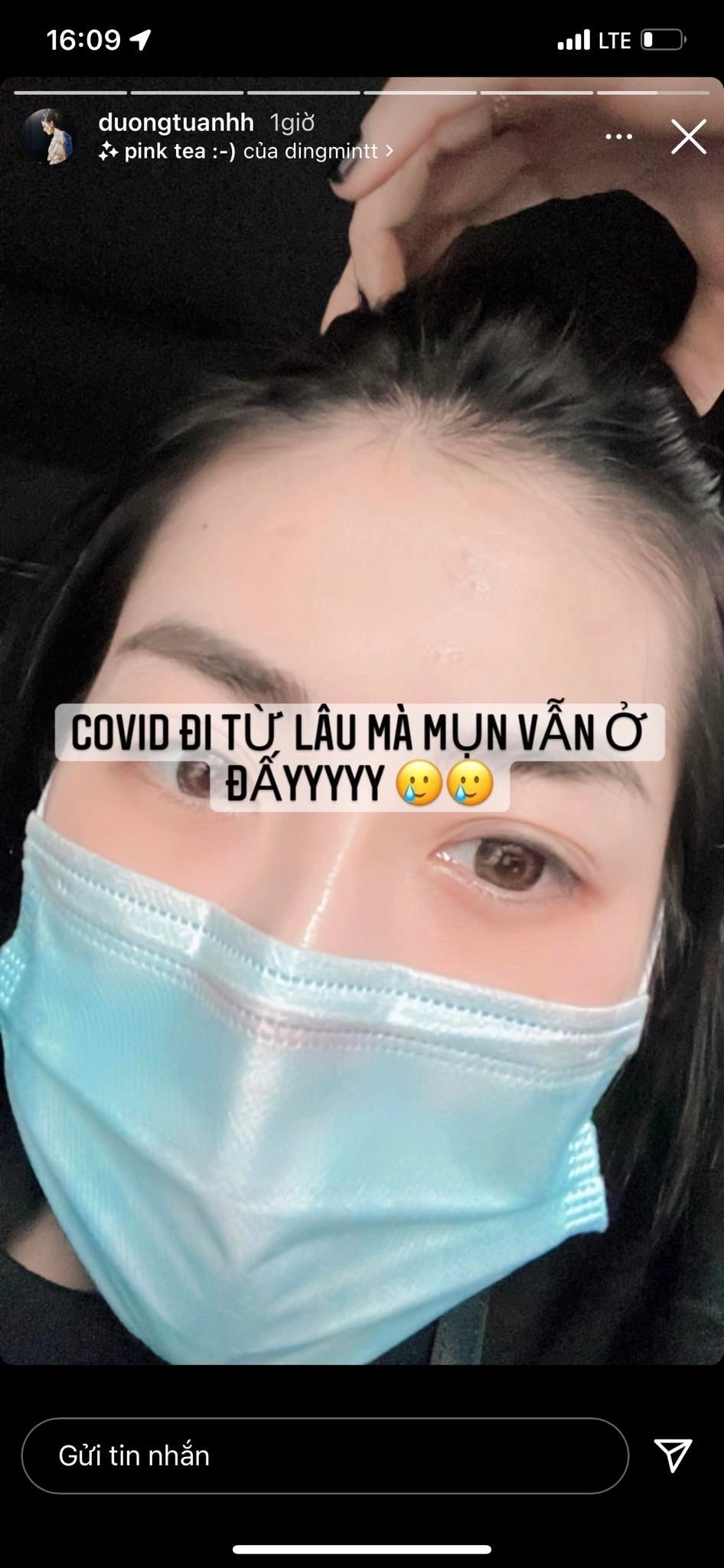 Dàn chân dài đuối sắc hậu covid minh tú nhợt nhạt dương tú anh nổi mụn đỗ hà rụng tóc - 2