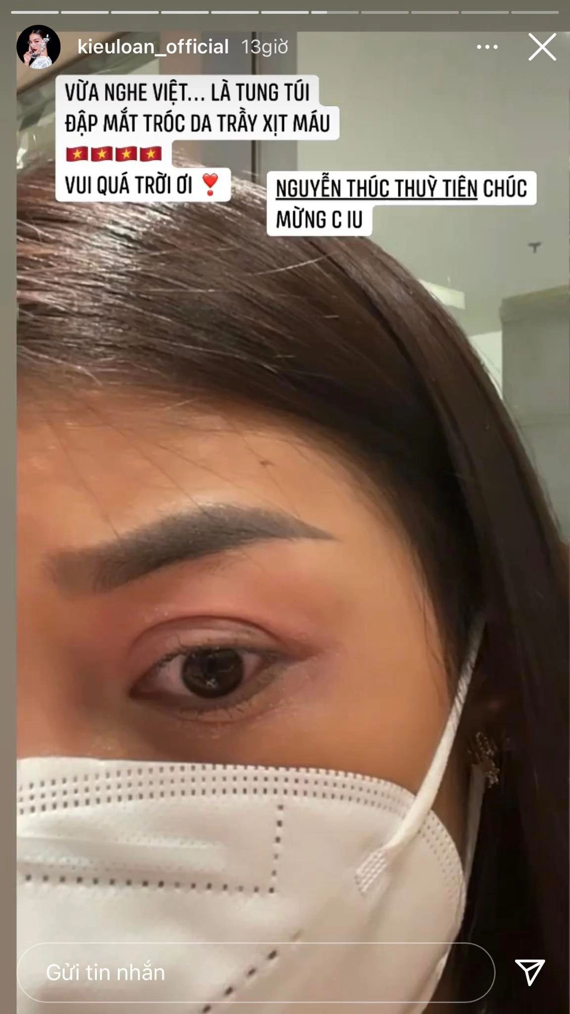 Dàn hoa hậu livestream khóc ăn mừng chiến thắng của thuỳ tiên nhan sắc mộc ngỡ ngàng - 3