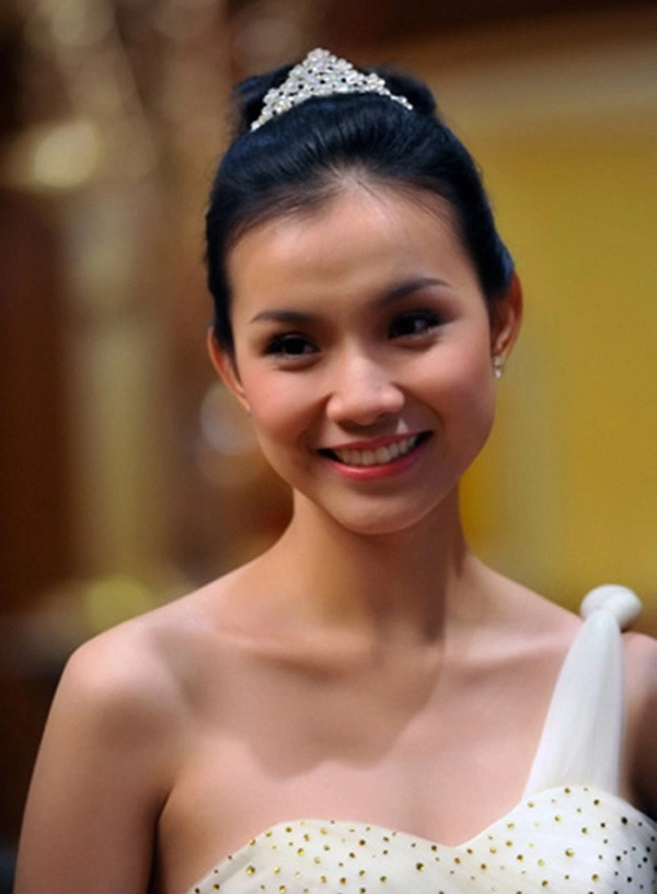 Đăng quang hơn 13 năm nàng hậu này giờ đây mới dám đi tiêm cằm - 1