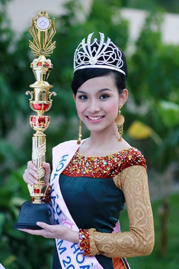 Đăng quang hơn 13 năm nàng hậu này giờ đây mới dám đi tiêm cằm - 2