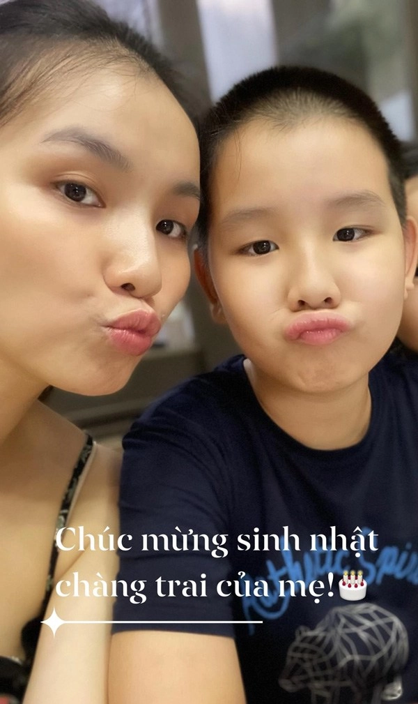 Đăng quang hơn 13 năm nàng hậu này giờ đây mới dám đi tiêm cằm - 14