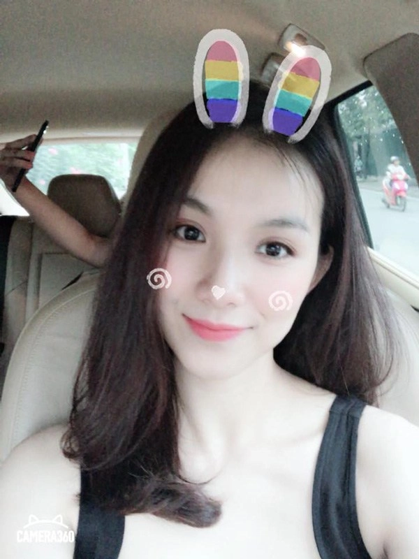 Đăng quang hơn 13 năm nàng hậu này giờ đây mới dám đi tiêm cằm - 17