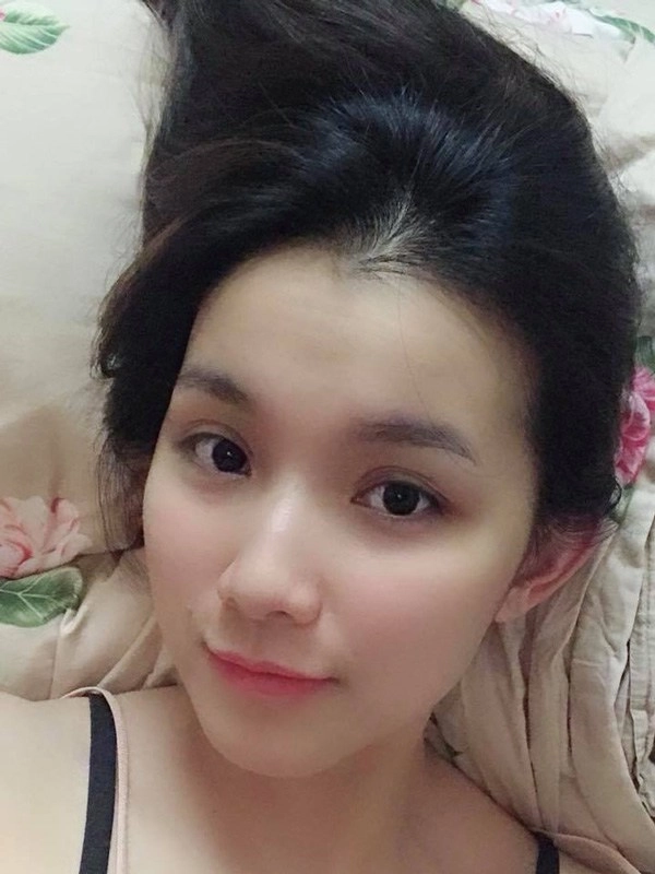 Đăng quang hơn 13 năm nàng hậu này giờ đây mới dám đi tiêm cằm - 18