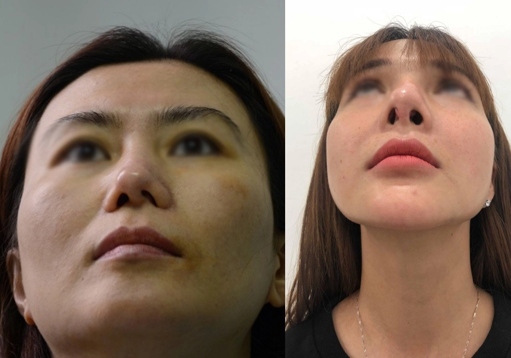 Dao kéo hỏng cái khổ của bệnh nhân và cái khó của bác sĩ - 2