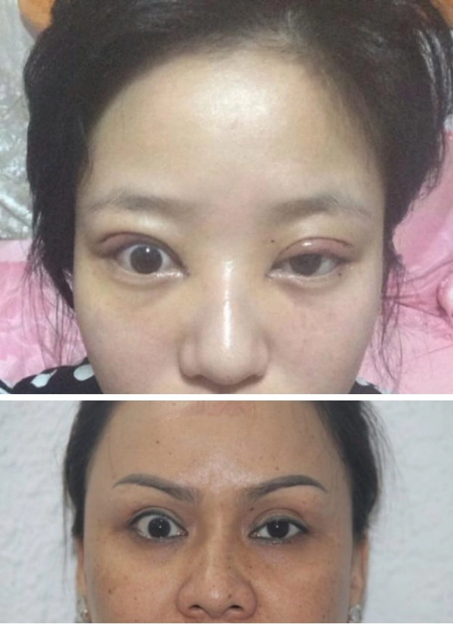Dao kéo hỏng cái khổ của bệnh nhân và cái khó của bác sĩ - 5
