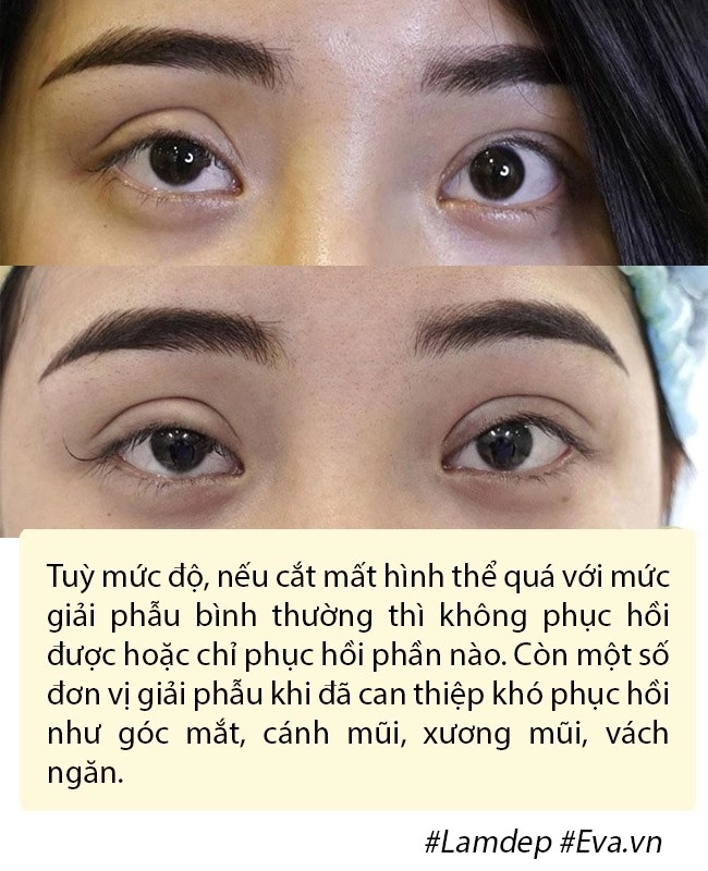 Dao kéo hỏng cái khổ của bệnh nhân và cái khó của bác sĩ - 9