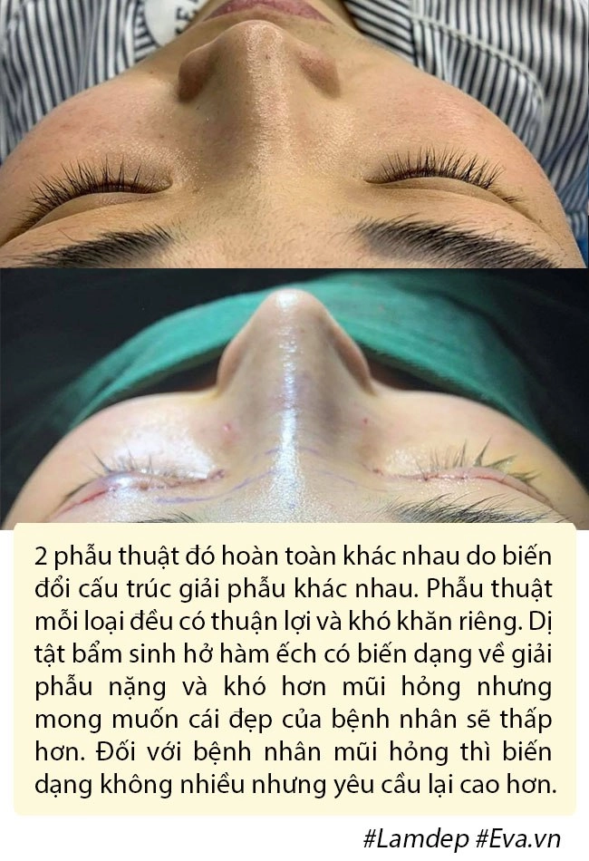 Dao kéo hỏng cái khổ của bệnh nhân và cái khó của bác sĩ - 11
