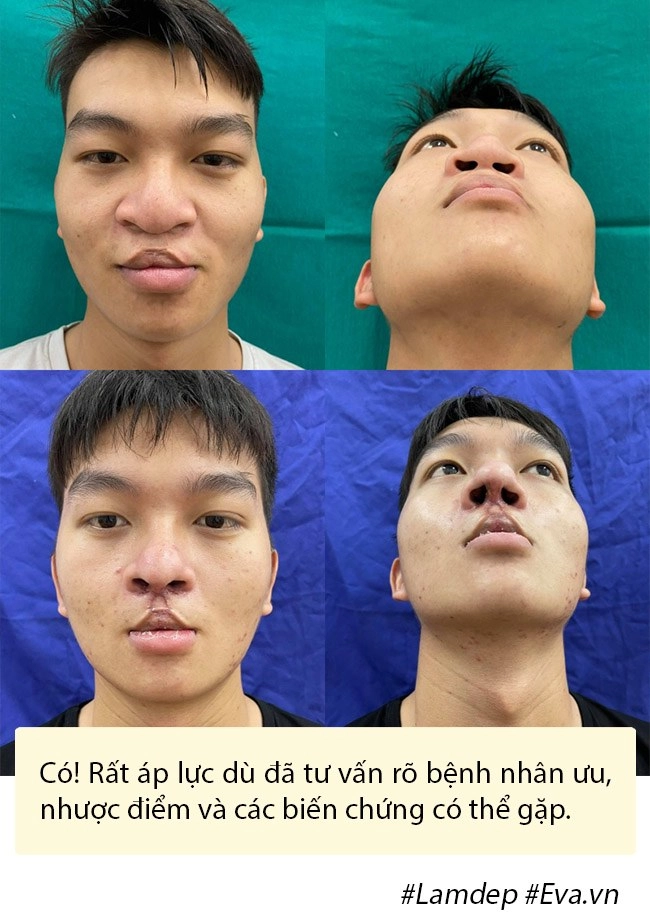 Dao kéo hỏng cái khổ của bệnh nhân và cái khó của bác sĩ - 13