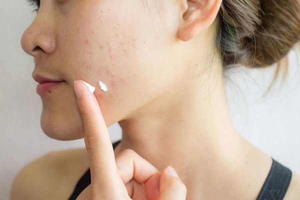 Dầu tầm xuân có tác dụng làm đẹp thần thánh như người ta đồn - 5