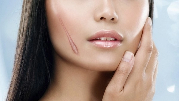Dầu tầm xuân có tác dụng làm đẹp thần thánh như người ta đồn - 6