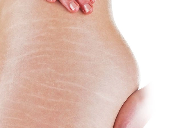 Dầu tầm xuân có tác dụng làm đẹp thần thánh như người ta đồn - 7
