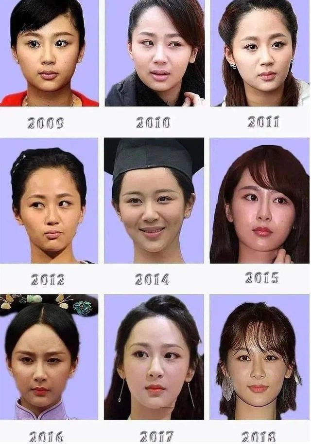 Đây là mỹ nữ nhất quyết phủ nhận tin phẫu thuật thẩm mỹ mà không ai tin - 18