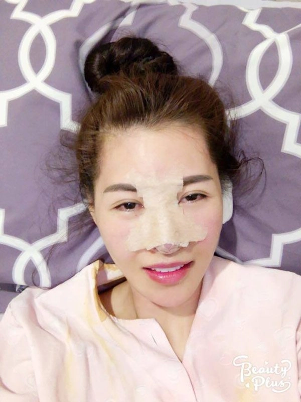 Đây mới là người đẹp phẫu thuật thẩm mỹ nhiều nhất nhì showbiz việt - 9