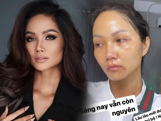 Đẹp như thiều bảo trâm vẫn có một điểm yếu phải đốt bộn tiền để vớt vát - 10