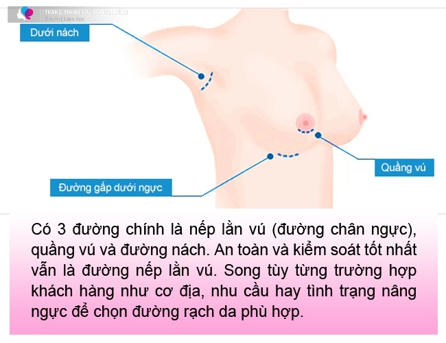 Đi nâng ngực gái xinh khóc thét vì đường rạch nách xấu sẹo dài nửa bàn tay - 7