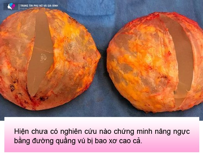 Đi nâng ngực gái xinh khóc thét vì đường rạch nách xấu sẹo dài nửa bàn tay - 11