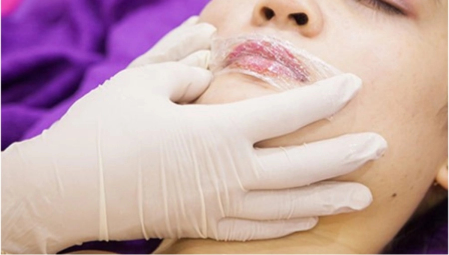 Đi phun môi ăn tết gái xinh số nhọ nhận về cái kết môi sưng như quả chuối mắn - 5