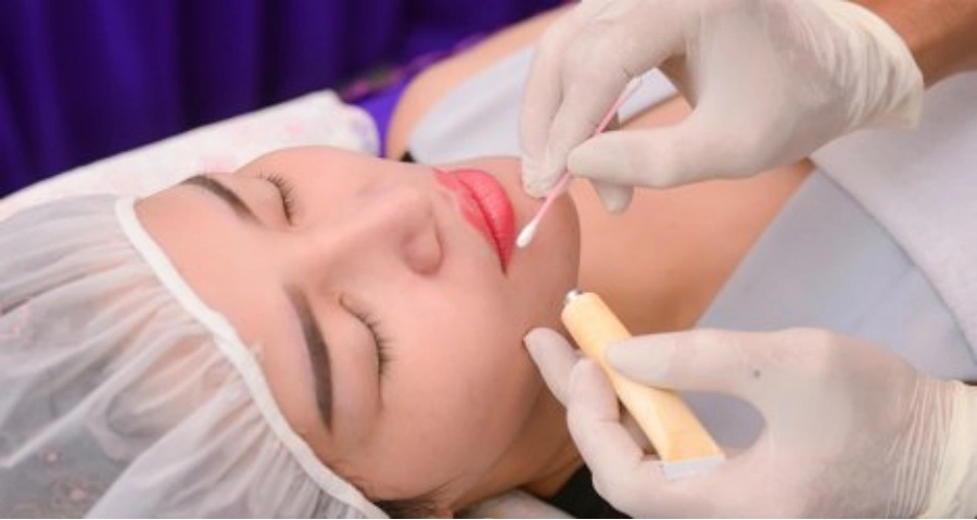 Đi phun môi ăn tết gái xinh số nhọ nhận về cái kết môi sưng như quả chuối mắn - 6
