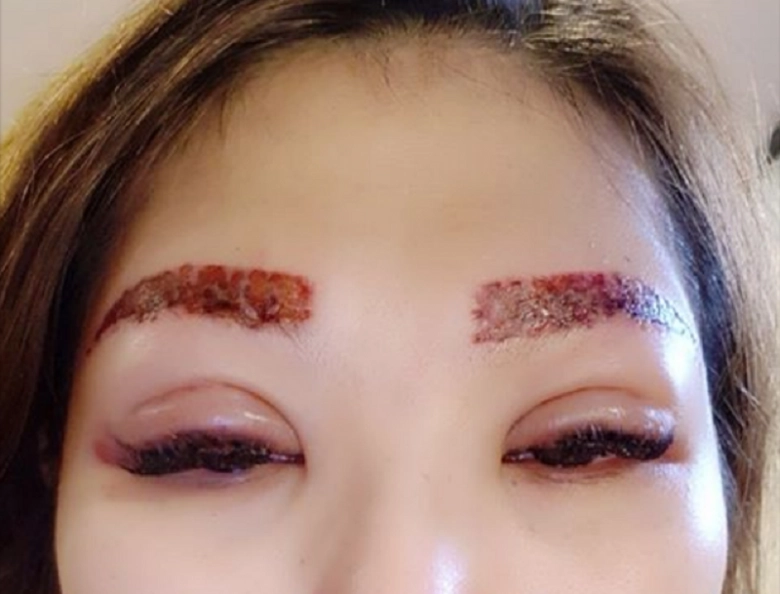 Điêu khắc chân mày con dao hai lưỡi có thể làm vẻ đẹp của bạn tan biến - 4