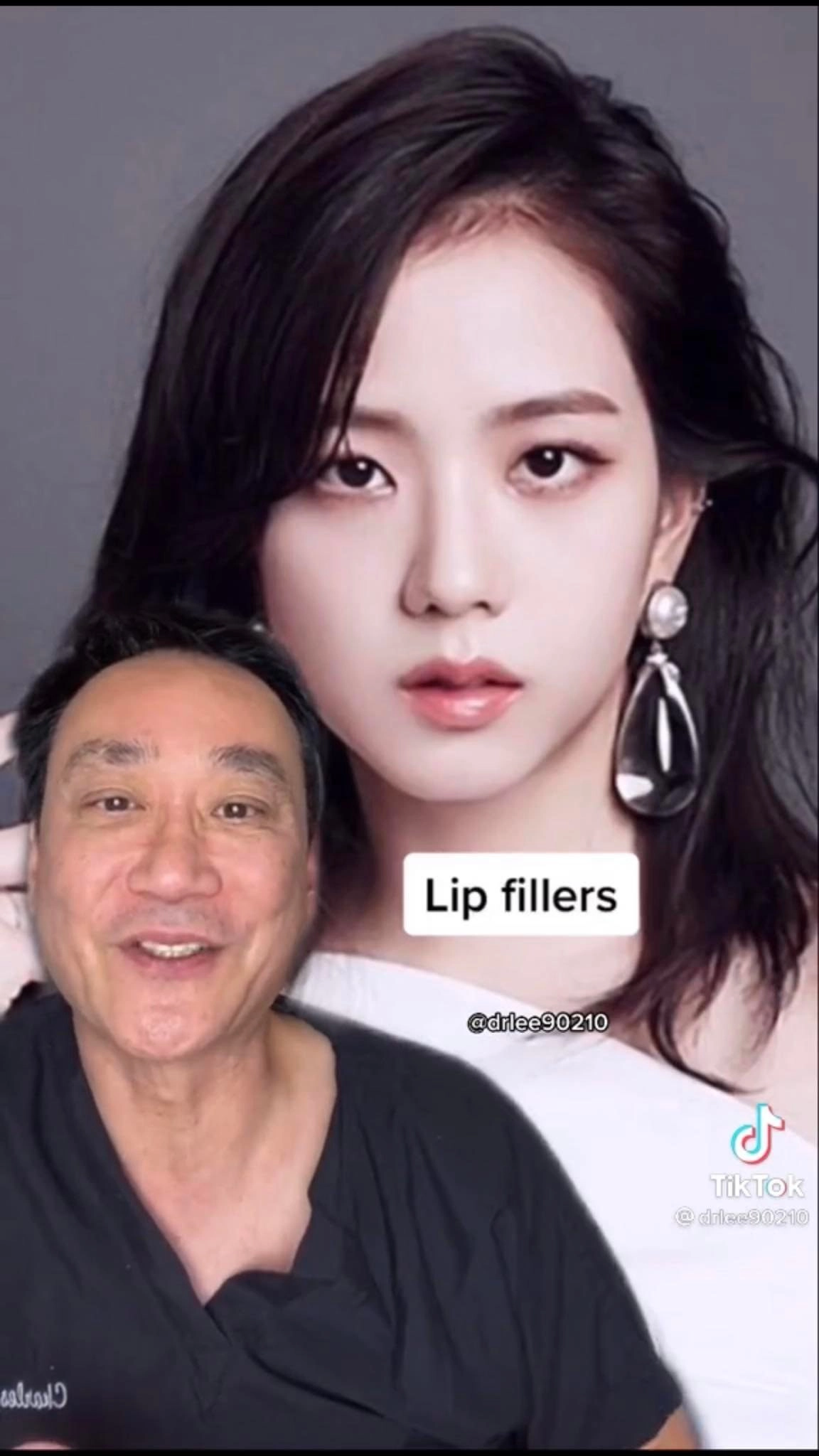 Đỉnh cao thẩm mỹ như không thẩm mỹ tại hàn blackpink sửa gần hết riêng lisa tiêu gần 1 tỷ - 11
