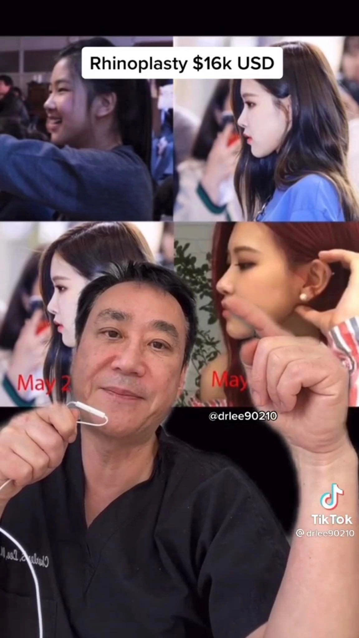 Đỉnh cao thẩm mỹ như không thẩm mỹ tại hàn blackpink sửa gần hết riêng lisa tiêu gần 1 tỷ - 13