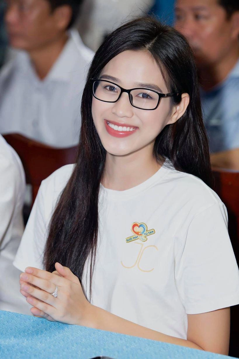 Đỗ thị hà công khai tu sửa hàm răng nhưng lại chối đây đẩy 1 bộ phận khác - 6
