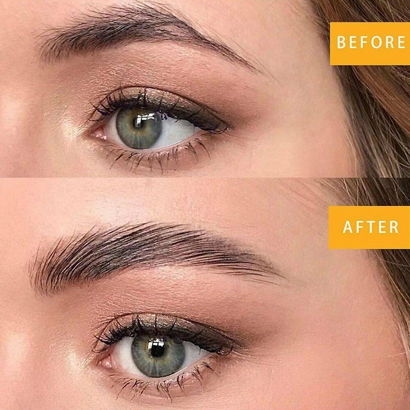 Đỗ thị hà công khai tu sửa hàm răng nhưng lại chối đây đẩy 1 bộ phận khác - 9