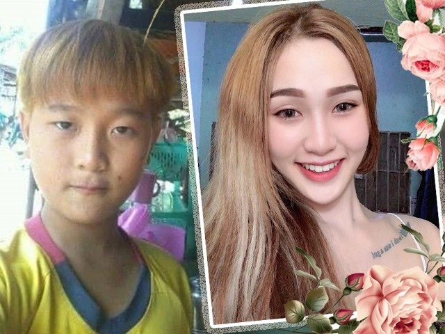Đỗ thị hà công khai tu sửa hàm răng nhưng lại chối đây đẩy 1 bộ phận khác - 11