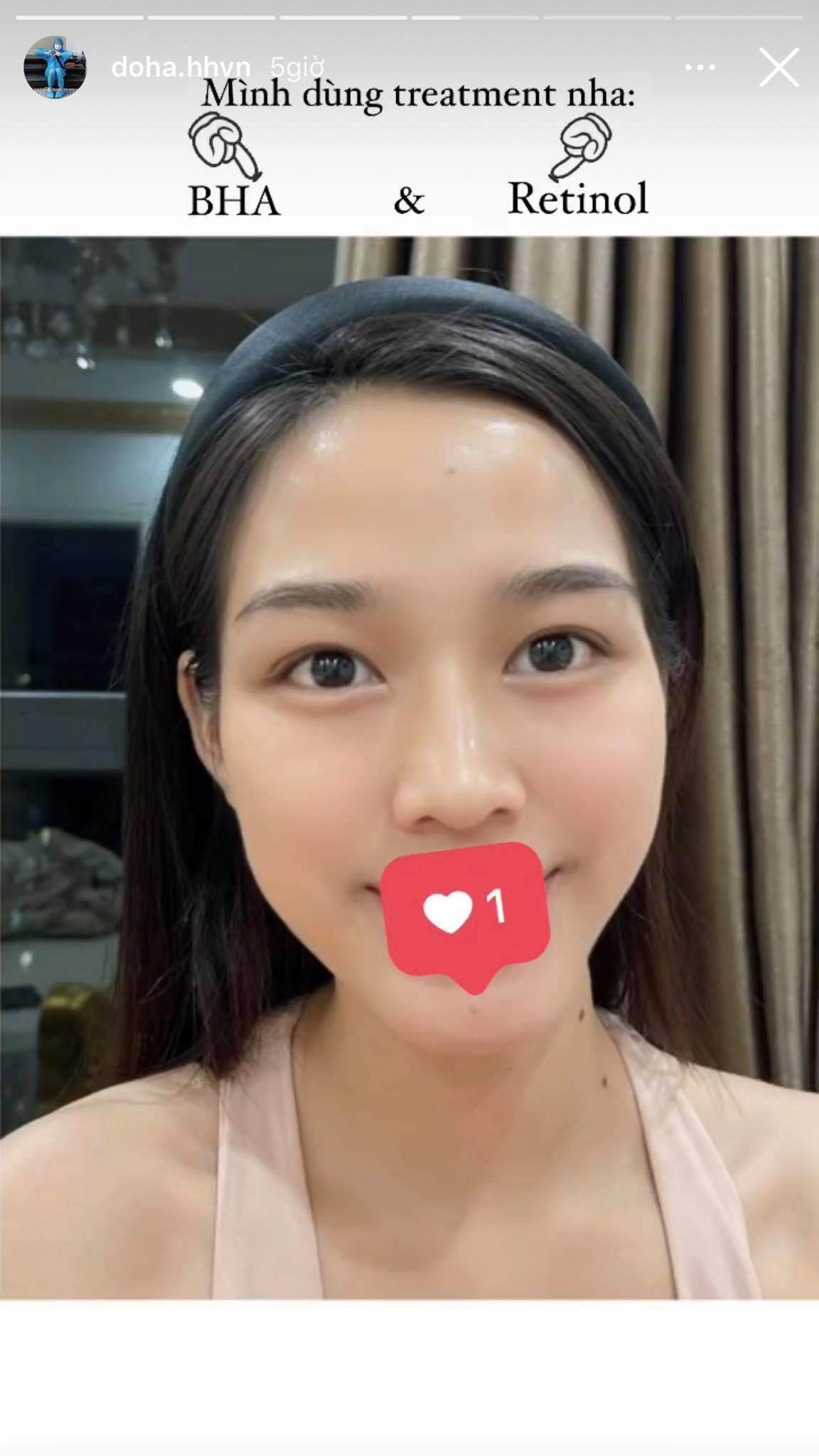 Đỗ thị hà đu trend dùng acid lên mặt da bong tróc nhưng kết quả sau 1 tháng mới phục - 3