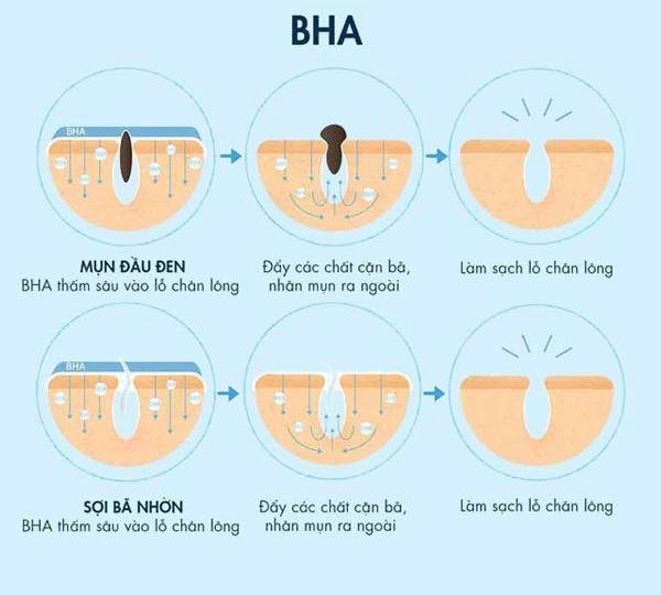 Đỗ thị hà đu trend dùng acid lên mặt da bong tróc nhưng kết quả sau 1 tháng mới phục - 5