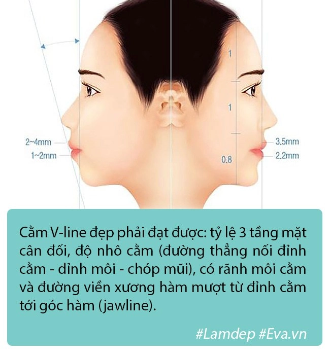 Độn cằm là phương pháp pttm rất đơn giản nhưng tại sao vẫn có nhiều ca biến chứng - 3