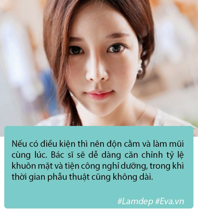 Độn cằm là phương pháp pttm rất đơn giản nhưng tại sao vẫn có nhiều ca biến chứng - 6