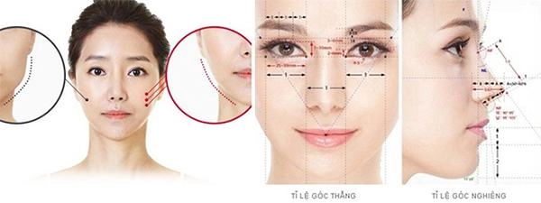 Độn cằm v line là gì độn cằm có đau và nguy hiểm không - 3
