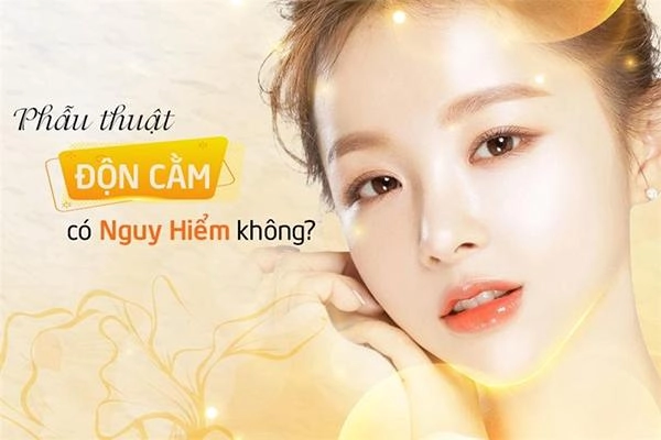 Độn cằm v line là gì độn cằm có đau và nguy hiểm không - 6