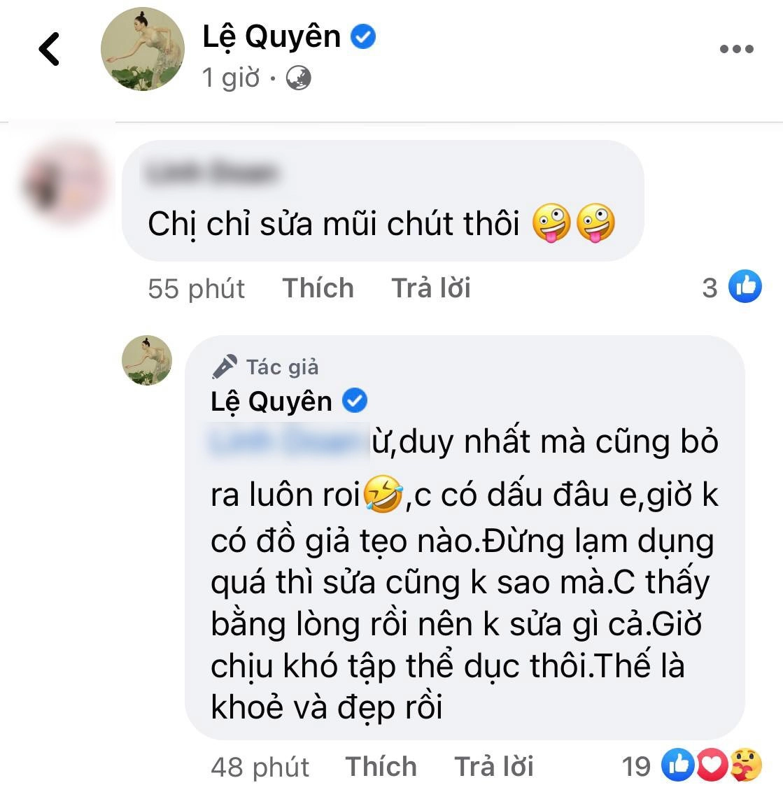 Dù đã rút sụn mũi dáng mũi của lệ quyên vẫn thon gọn bất ngờ - 9
