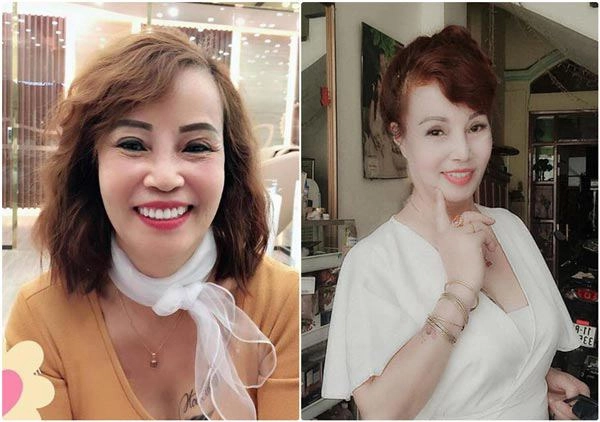 Phẫu thuật thẩm mỹ hết mặt cô dâu 62 tuổi vẫn bị da nhăn nheo chảy xệ - 3