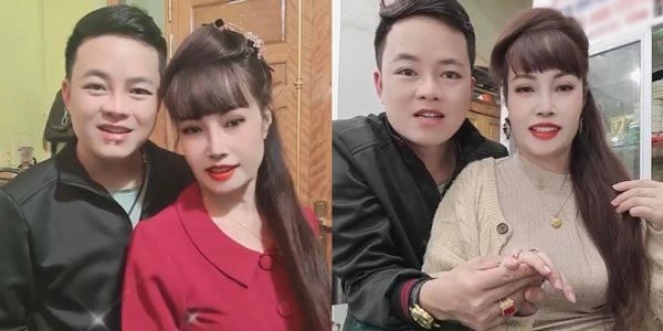 Phẫu thuật thẩm mỹ hết mặt cô dâu 62 tuổi vẫn bị da nhăn nheo chảy xệ - 4