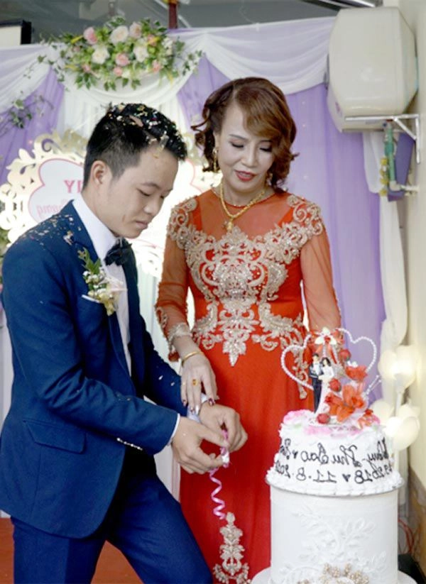 Phẫu thuật thẩm mỹ hết mặt cô dâu 62 tuổi vẫn bị da nhăn nheo chảy xệ - 7