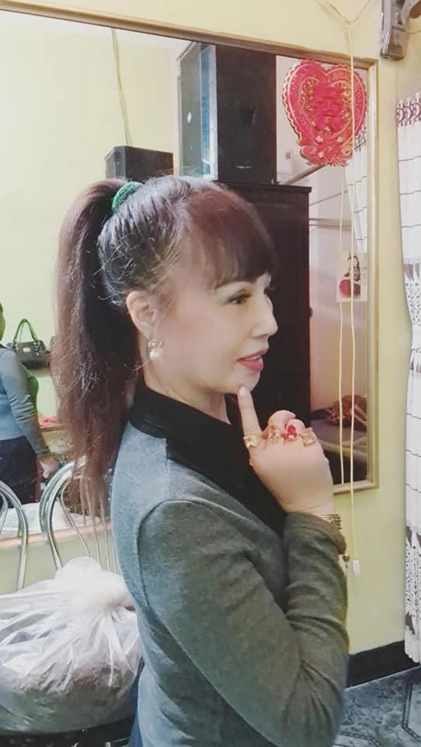 Phẫu thuật thẩm mỹ hết mặt cô dâu 62 tuổi vẫn bị da nhăn nheo chảy xệ - 9